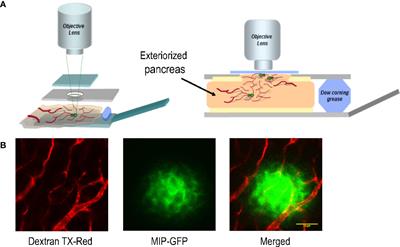 In Vivo ZIMIR Imaging of Mouse Pancreatic Islet Cells Shows Oscillatory Insulin Secretion